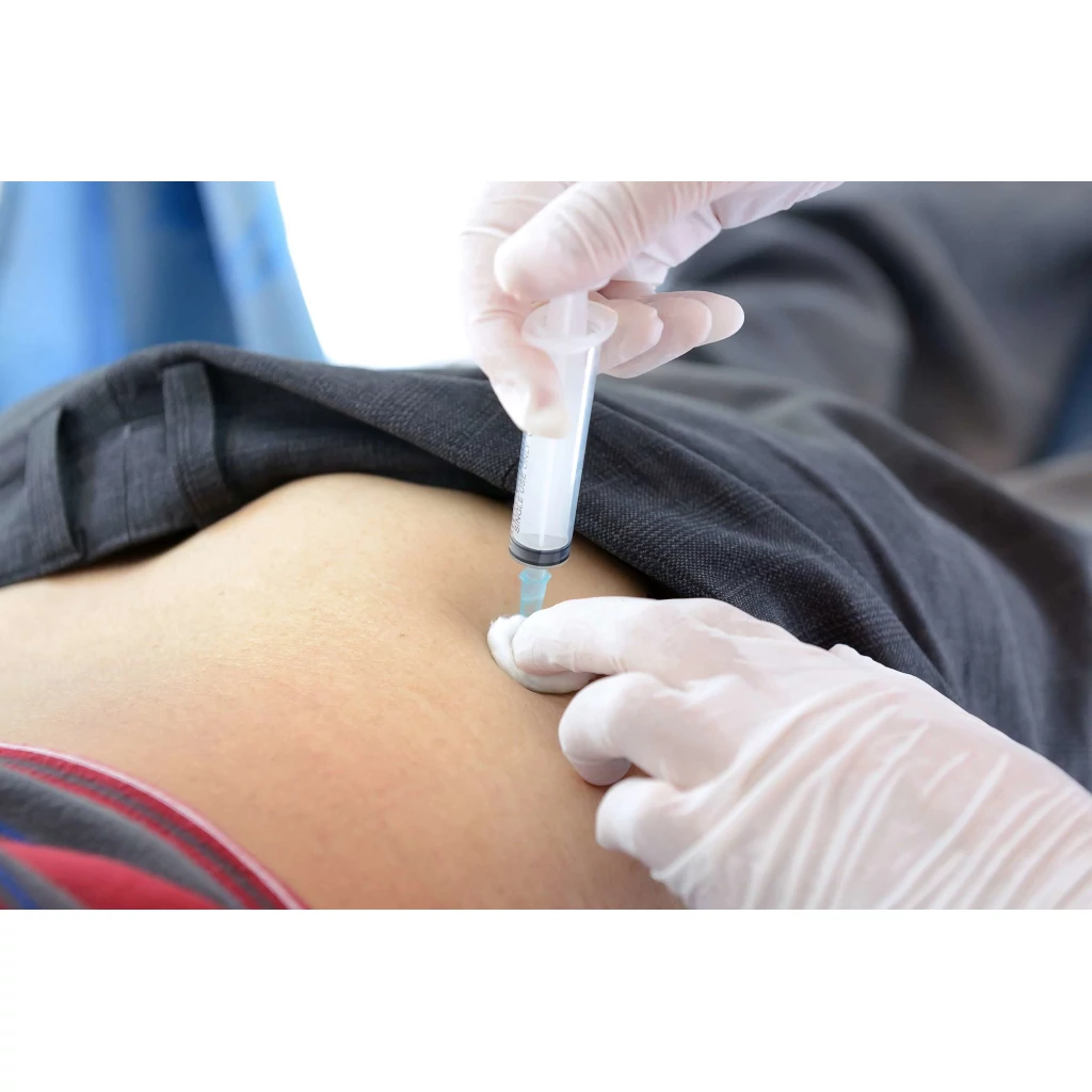 Injection Volume Guide Injection Volume Guide